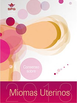 Consenso Miomas Uterinos